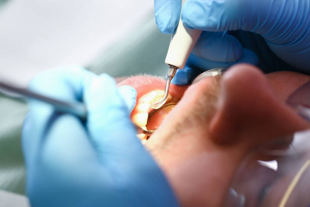 Best Emergency Dental Surgery in Azle, TX
