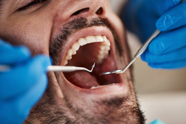 Best Pediatric Emergency Dentist in Azle, TX