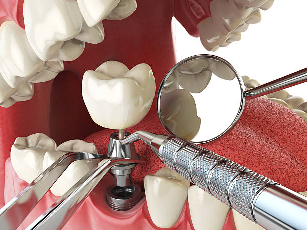 Best Emergency Dental Surgery in Azle, TX